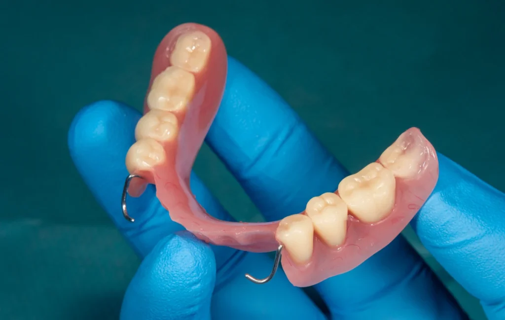 prothese adjointe numerique conception cad cam Prothèse adjointe numérique label-dent