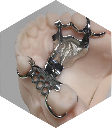 prothese conjointe fabrication cad cam Nos Technologies label-dent