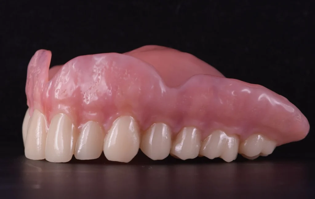 prothese dentaire fabrication laboratoire moderne Prothèse adjointe numérique label-dent