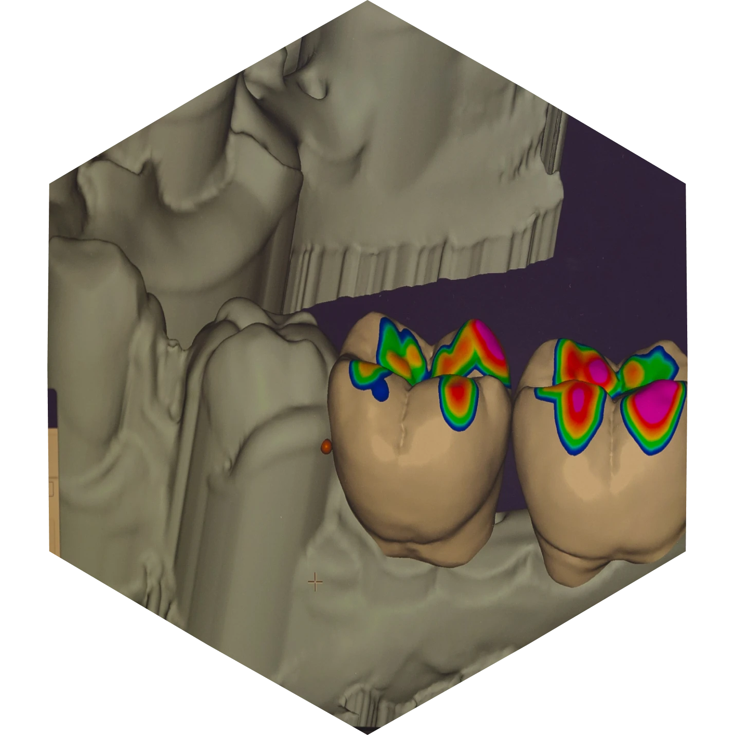 prothesiste dentaire expertise prothese laboratoire Nos Technologies label-dent