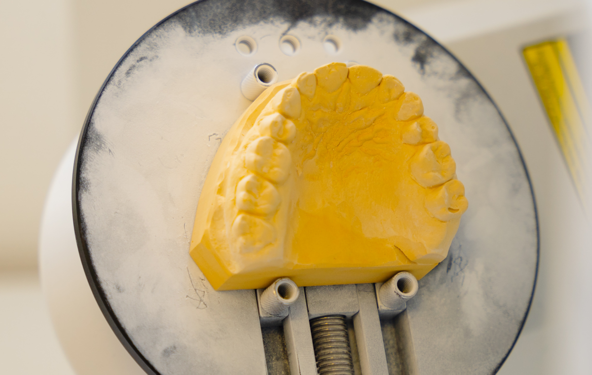 laboratoire dentaire flux numerique metz Accueil label-dent