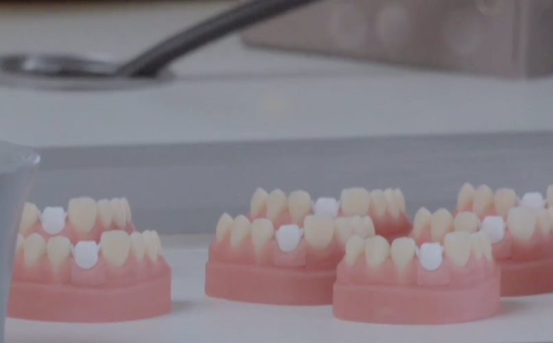 prothese conjointe dentaire ajustement precision Formation céramique (avec les MOF Denis Elkaim et Sébastien Milliasseau) label-dent