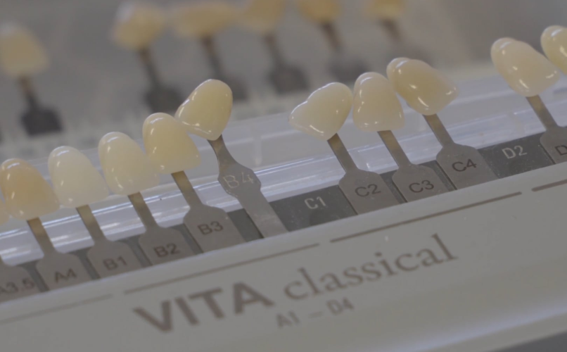 prothese conjointe laboratoire dentaire expert Formation Single Central Yuki Momma label-dent