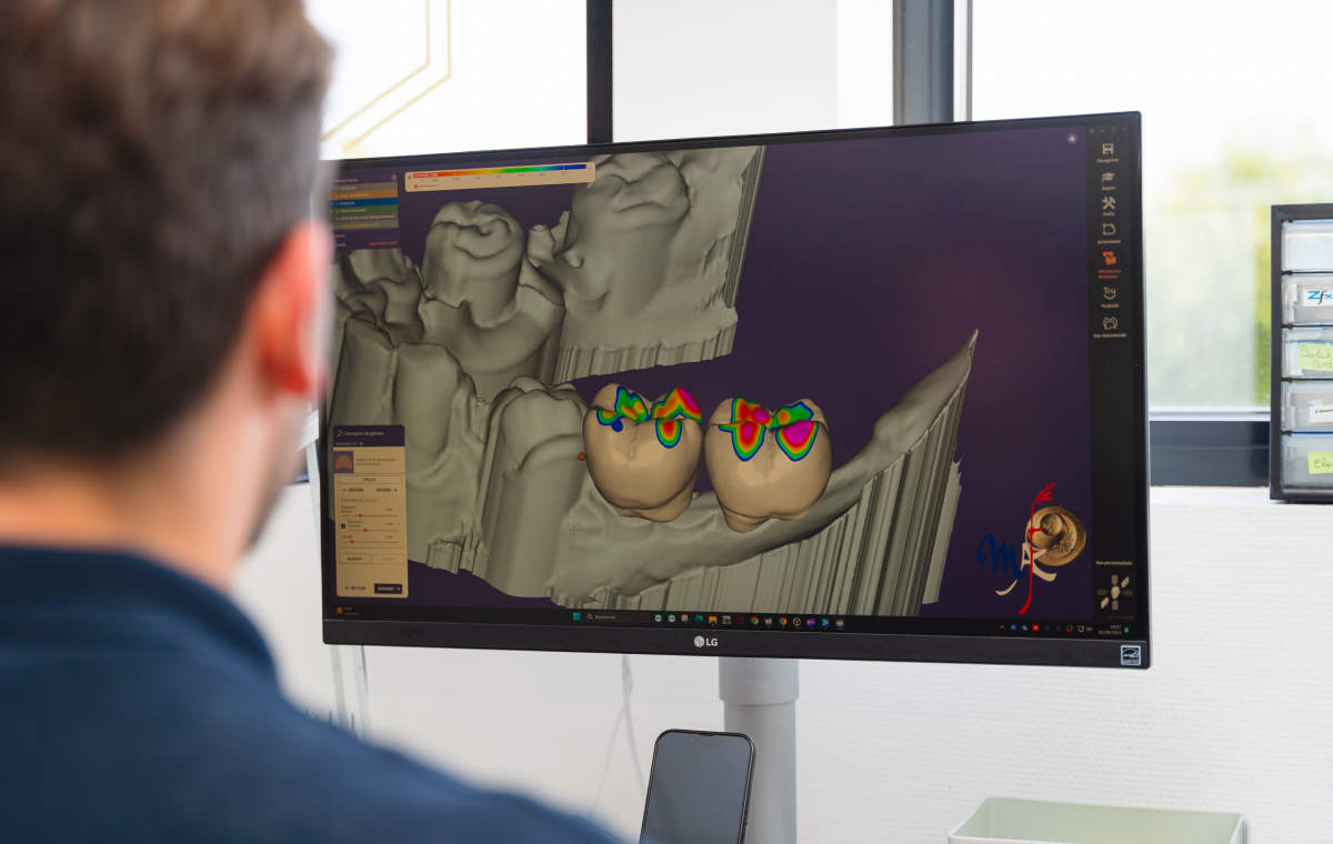 prothesiste dentaire laboratoire haute precision Accueil label-dent